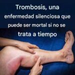 Las 6 Infusiones Esenciales para la Salud Arterial: Protege tu Corazón de Forma Natural 5 34 compressed