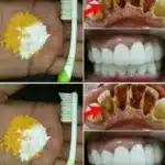 Cúrcuma y Bicarbonato de Sodio: Blanqueamiento Dental Natural para Dientes Blancos 10 240