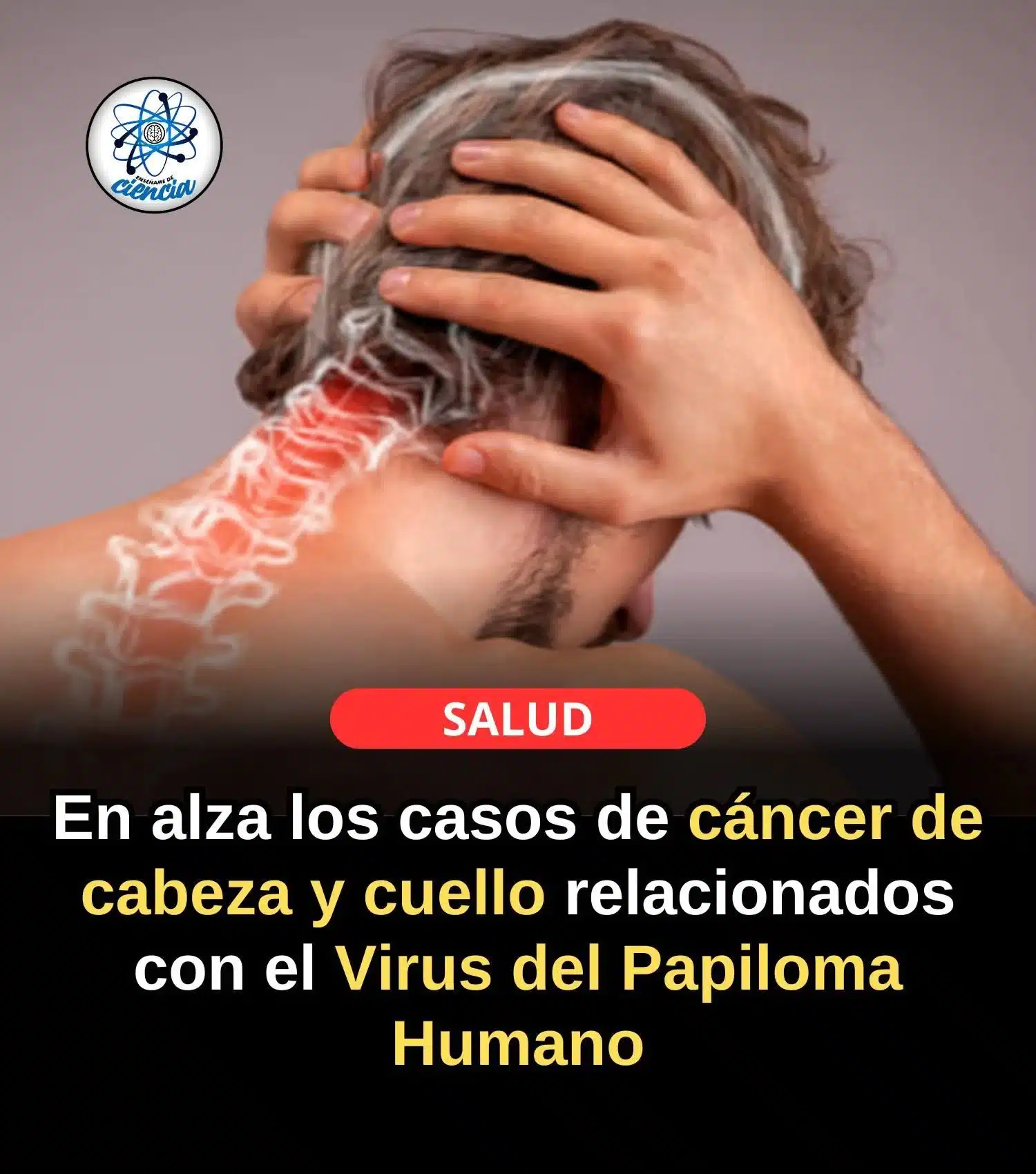 Aumentan los casos de cáncer de cabeza y cuello asociados al Virus del Papiloma Humano... Ver más