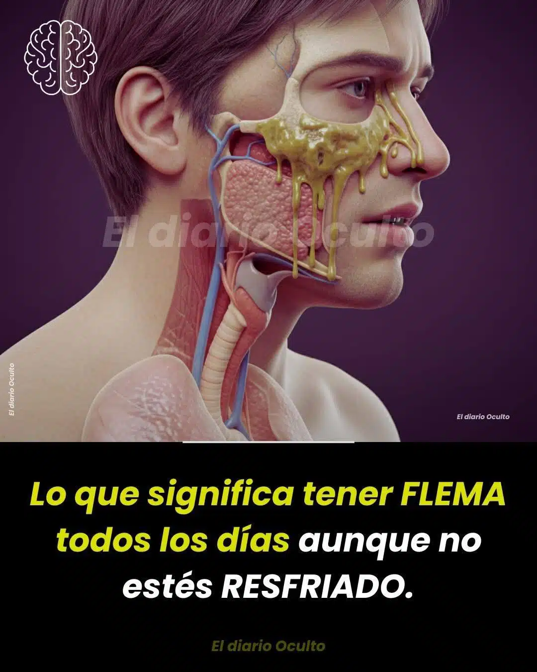 Lo que significa tener FLEMA todos los días aunque no estés RESFRIADO... Ver más