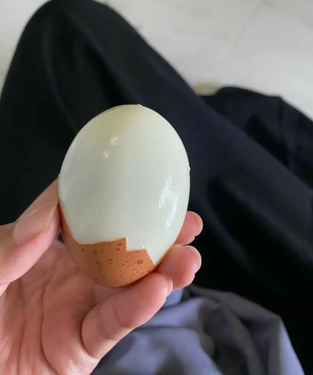 Frecuencia Urinaria: ¿Orinar Demasiado Es Normal? Causas, Síntomas y Cuándo Preocuparse 2 Los médicos revelan que comer huevos cocidos por la mañana provoca... Ver más