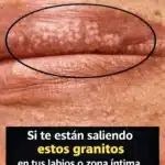 Granitos Blancos en los Labios: Causas Comunes, Soluciones y Cuándo Ver al Dermatólogo 8 480