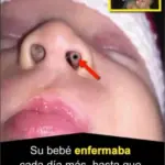Bebé enfermo descubre causa inesperada en nariz