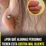 Costras con mal olor detrás de orejas causas