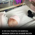 Gemelas, anencefalia y la mariposa morada