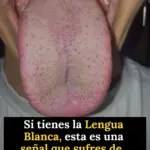 Lengua blanca: qué es, causas y cuidados