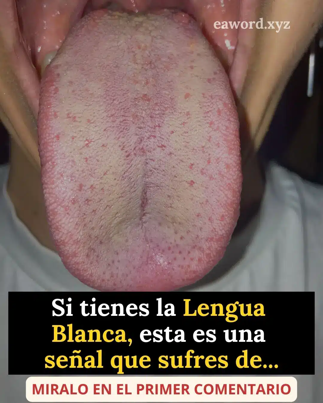 Lengua blanca: qué es, causas y cuidados