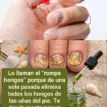 Remedio casero efectivo contra hongos de pies