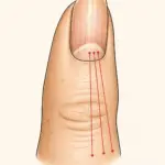 Uñas con rayas significado y remedios saludables 7 Uñas con rayas significado y remedios saludables