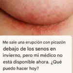 Winter Under Breast Rash Easy Home Remedies