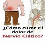 Aliviar y prevenir el dolor del nervio ciático 10 unnamed file 148