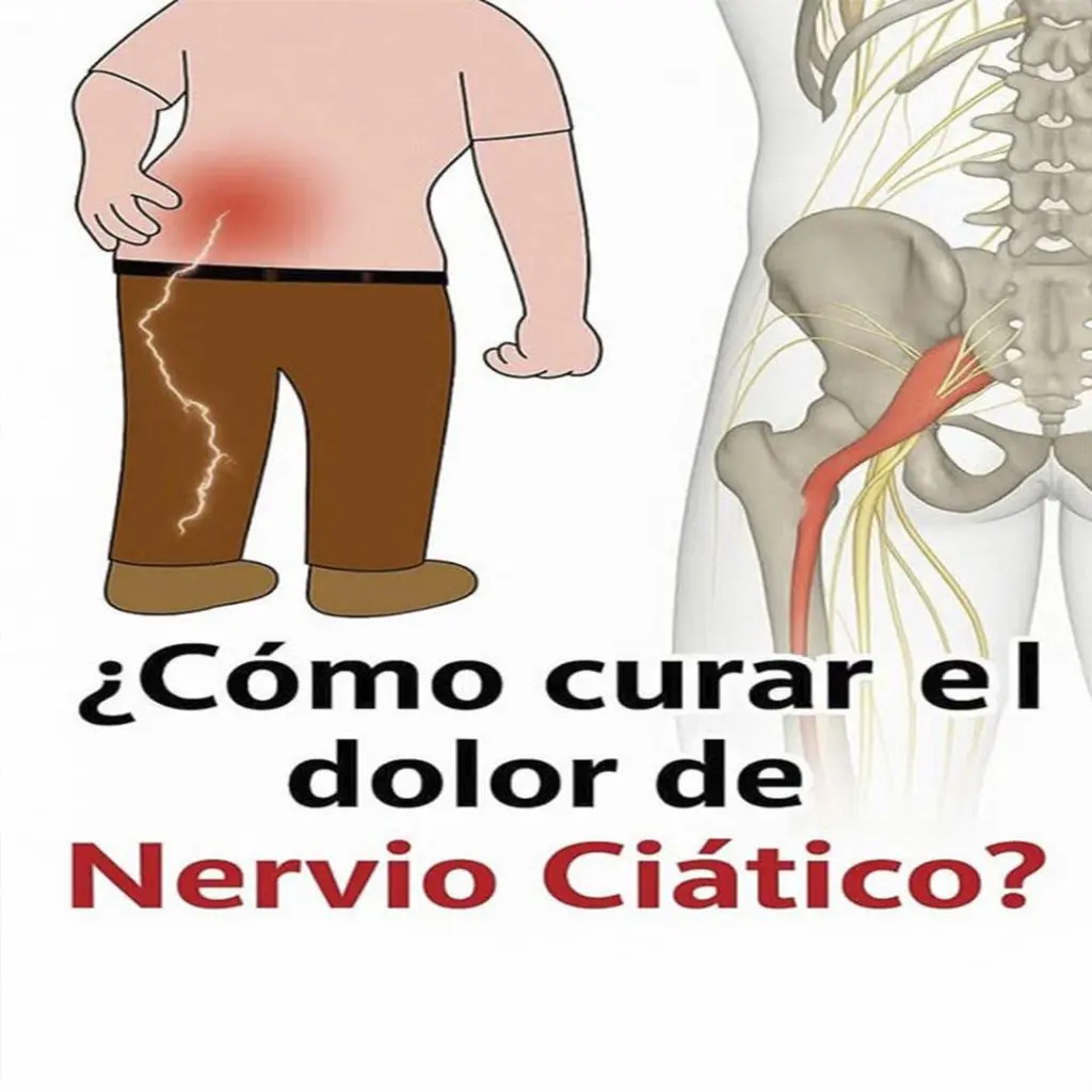 Tratamiento profesional para el dolor del nervio ciático