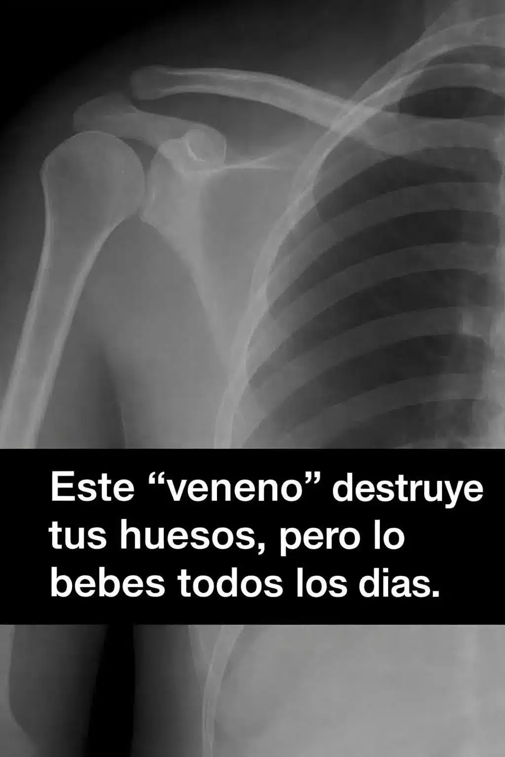 Tu bebida diaria daña tus huesos