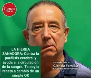 Beneficios del Árnica para Golpes, Inflamación y Salud 2 Beneficios del Árnica para Golpes, Inflamación y Salud