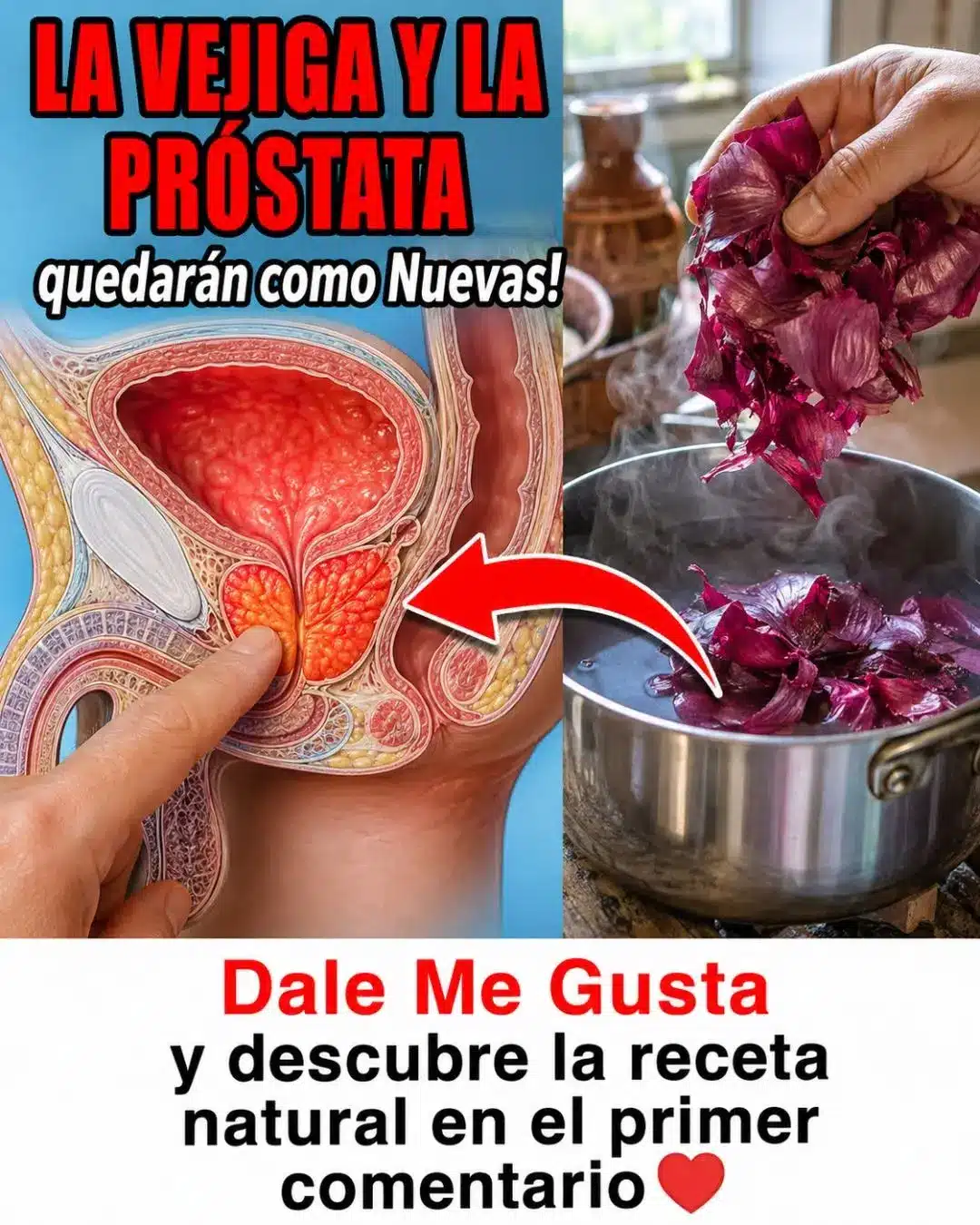 Apoyo natural vejiga y próstata: método casero