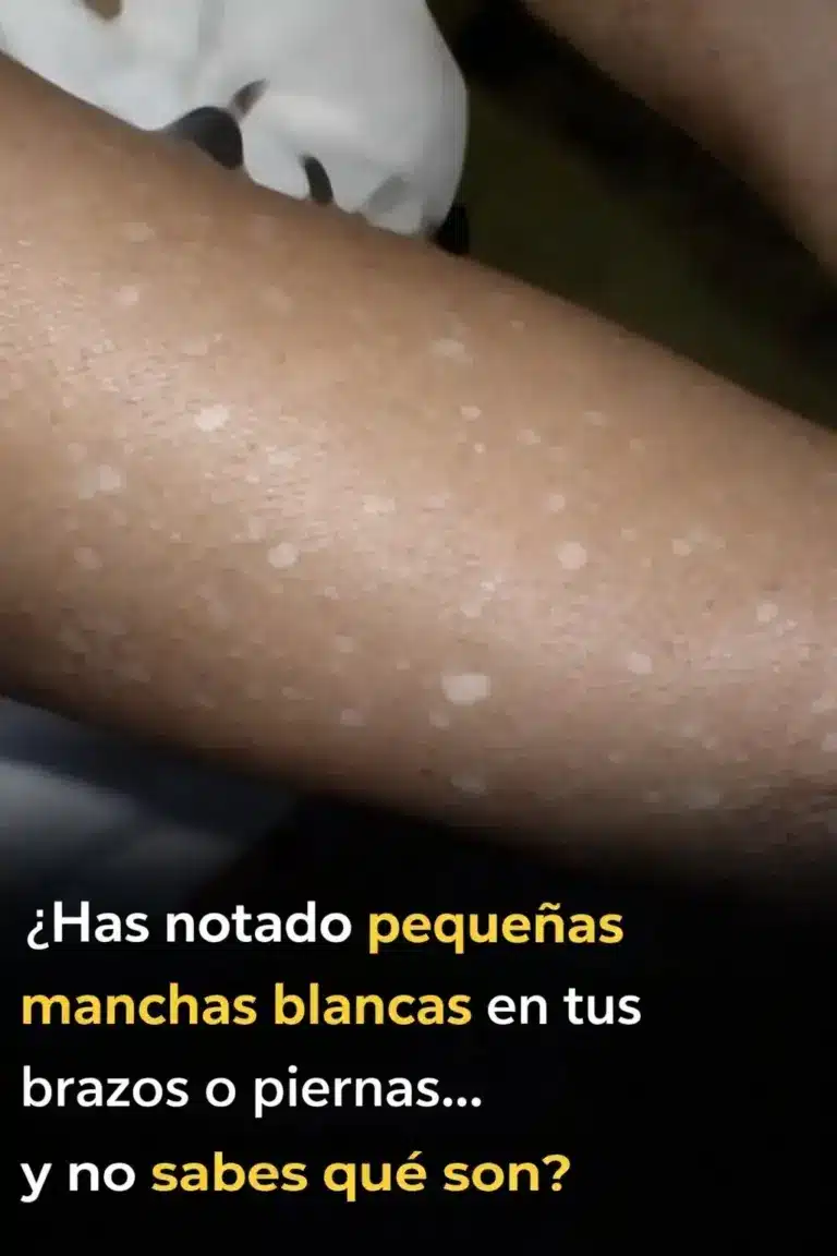 Manchas blancas en brazos y piernas: causas y tratamientos