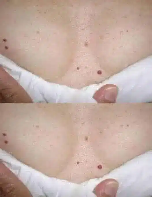 Señales de alerta temprana en tu cuerpo