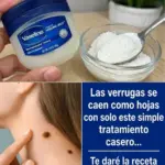 Cómo eliminar verrugas con vaselina eficazmente