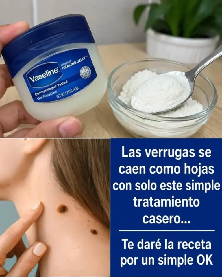 Cómo eliminar verrugas con vaselina eficazmente