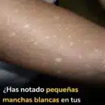 Causas de manchas blancas en brazos y piernas 10 Causas de manchas blancas en brazos y piernas