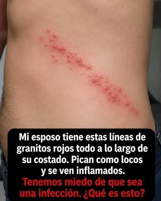 Enfermedad del ocio: por qué enfermas en vacaciones 2 Enfermedad del ocio: por qué enfermas en vacaciones