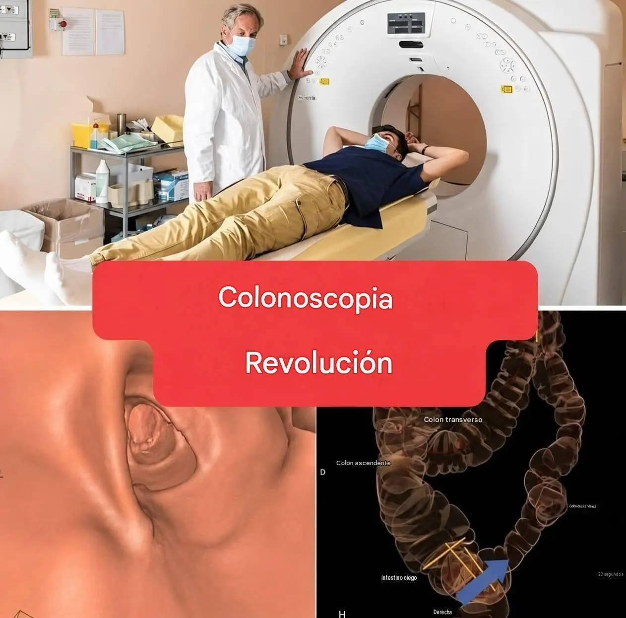 Nuevo método de colonoscopia no invasiva