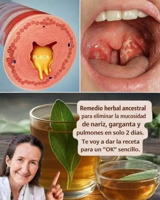 Remedio ancestral para eliminar mucosidad en 2 días 2 Remedio ancestral para eliminar mucosidad en 2 días