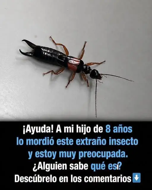 Picaduras de insectos en niños: qué hacer