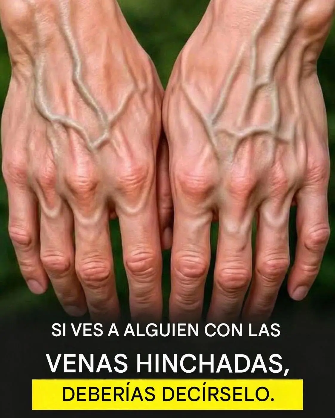 Por qué se ven tus venas: causas principales